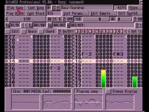Octamed REMIX: ADRDesign VS Massive Attack - Teardrop (download included)