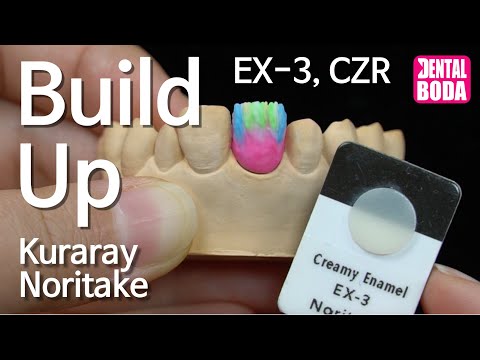 Kuraray Noritake EX 3 & CZR build up