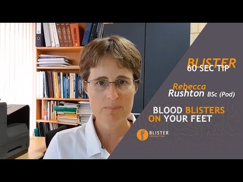 #9 Blood Blisters On Feet - Why Blood Enters The Blister - The Importance Of Pressure Management