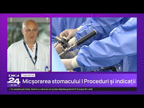 Operația de micșorare a stomacului – Dr. Florin Turcu | Spitalul Clinic SANADOR