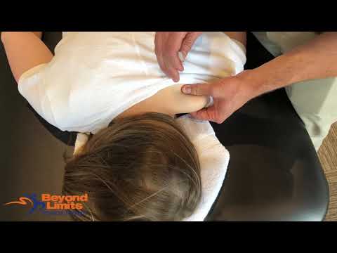 Dry Needling for the Upper Trapezius