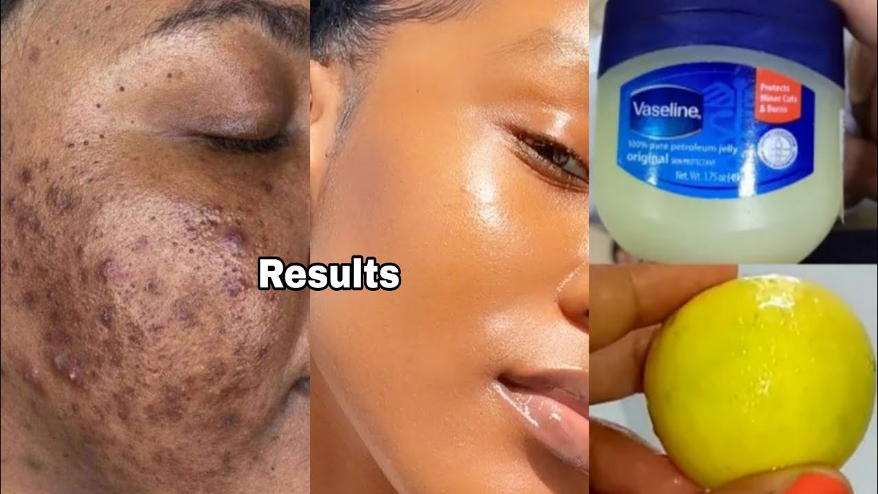 How to apply vaseline and lemon on face/ apply vaseline on your skin and see the magic