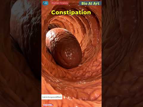 Constipation | Human Anatomy | Bio AI Art | 01