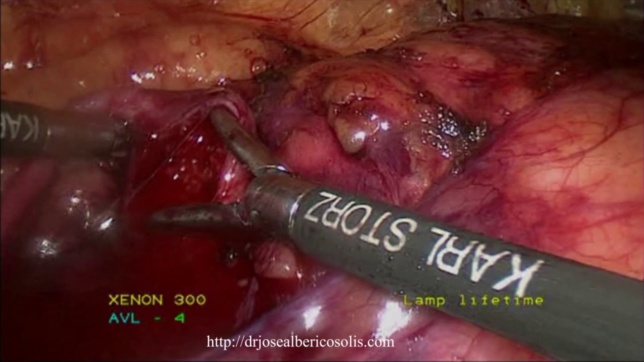 José Albérico Solís Rodríguez-8