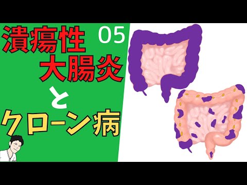 細菌性栗潰瘍 - 定義