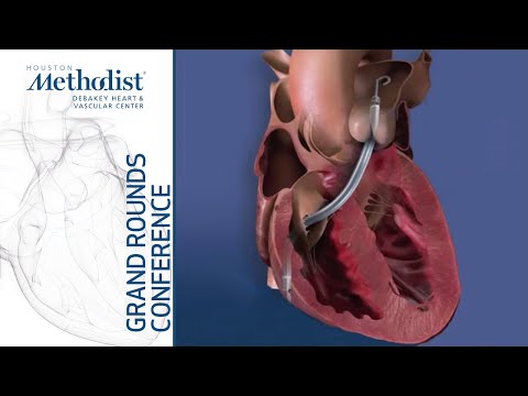 Radiation Safety (Akanksha Thakkar, MD) RV Failure Cardiogenic Shock (Isaac Tea, MD) May 20, 2021