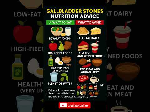 Gallbladder Stone Nutrition Tips: What to Eat (and Avoid)
