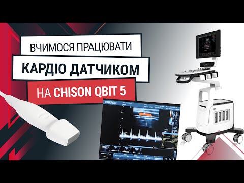 Кардиологический датчик для Chison Qbit 5 – обучение и функции - Статьи RH