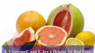 How to Get Rid From Yellow Eyes With Naturally Foods And Get White Eyes