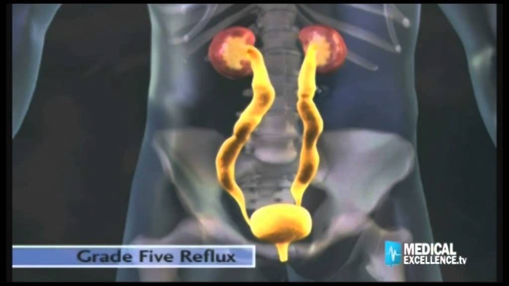 Sebastiano Cacciaguerra-21