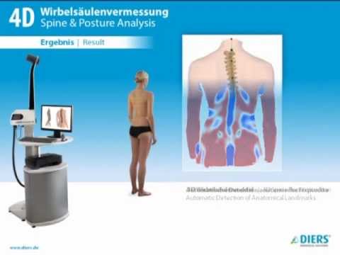 - Spondylos Laser Spine Lab - Spondylos Laser Spine Lab