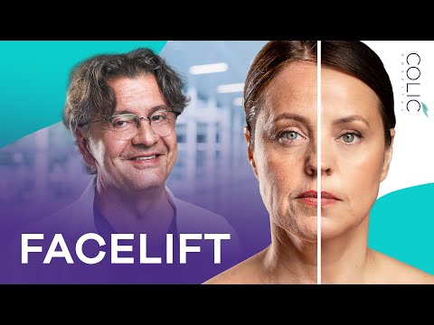 Dr Milan Colić o iskustvima pacijenata i procesu facelifting operacije zatezanja lica