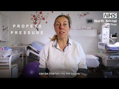Induction of Labour Video | North Bristol NHS Trust