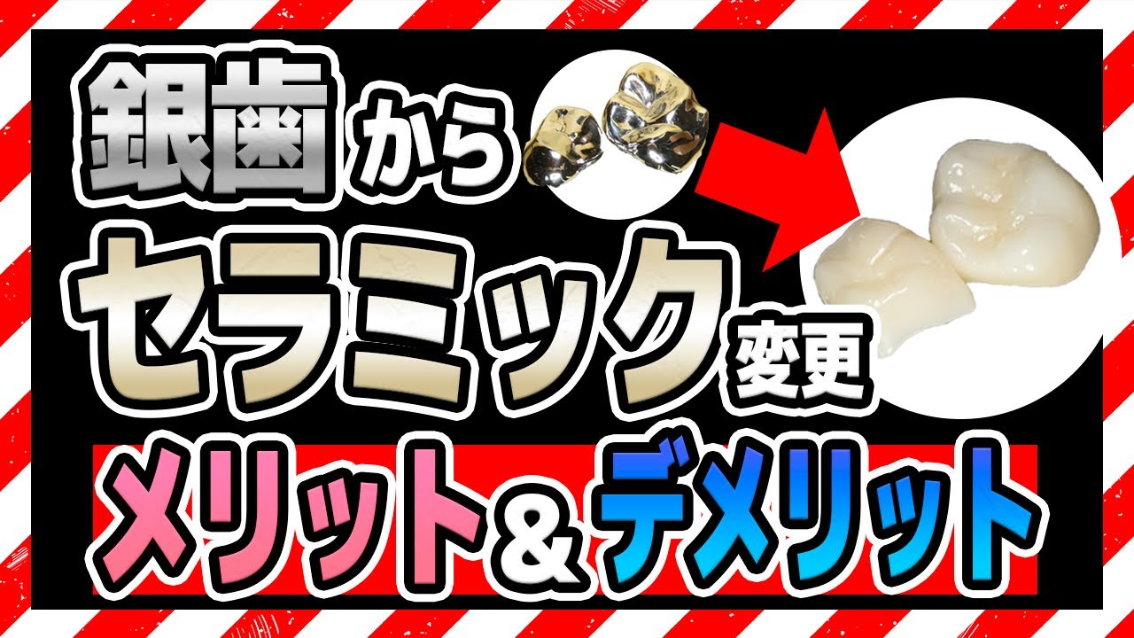 銀歯をセラミックに作り直したい方へ【メリット・デメリットを紹介】