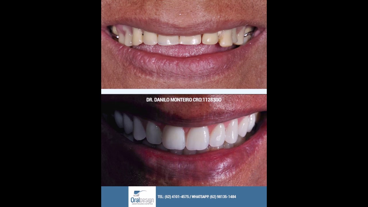 Danilo Monteiro Rezende Pereira-22