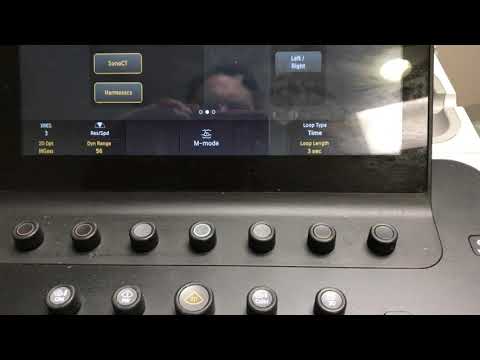3rd In Series How to operate Philips Epiq ultrasound machine