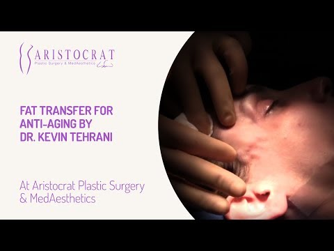 Fat Transfer for Anti-Aging- Dr. Kevin Tehrani