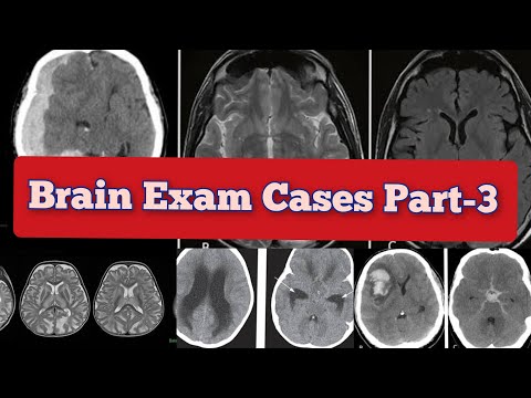 Radiology Viva Cases # 181-187 | Brain Exam Cases Part -3 #medical #radiology #ultrasound #doppler