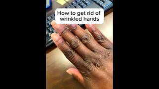 How to get rid of wrinkled hands | #wrinklestreatment #softhands