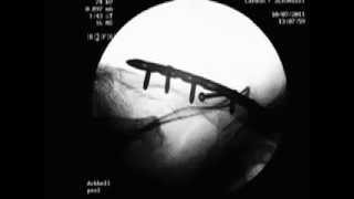 Face The Change - INXS