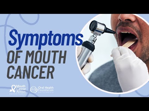 Mouth Cancer Symptoms