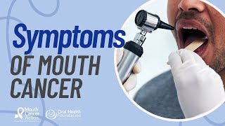 Mouth Cancer Symptoms