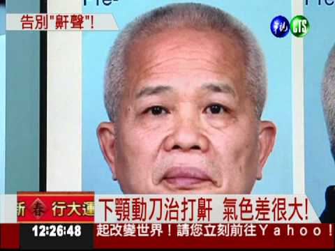 花15萬下顎動刀 向"打鼾"說再見!