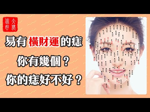 面部的痣