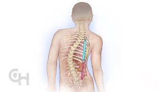 Thoracic Insufficiency Syndrome