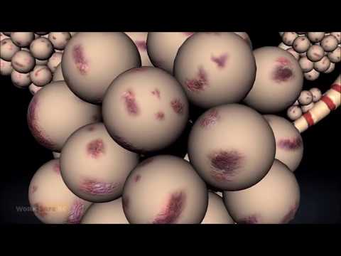 Hälsoproblem med betong damm