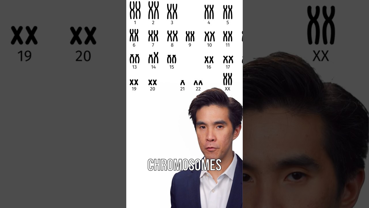 What's The Opposite Of Down Syndrome?