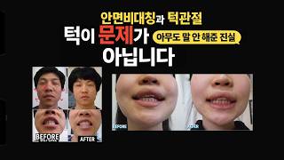 안면비대칭·턱관절장애, 교정해도 자꾸 틀어지는 진짜 이유 (원인은 턱이 아닙니다) 대진당