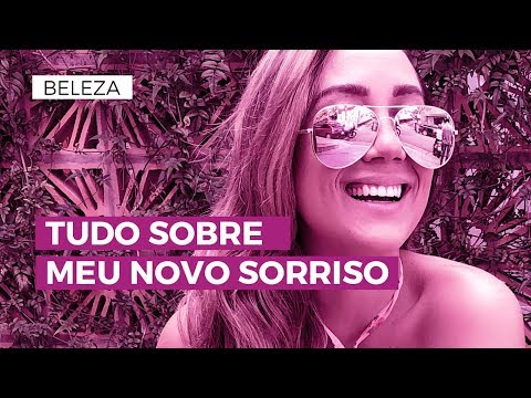 Tudo sobre o meu sorriso novo | CAMILA GAIO