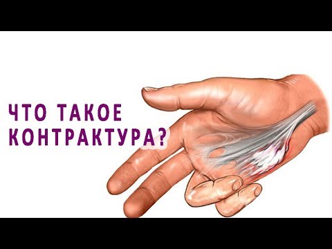 Импинджмент синдром плечевого сустава лечение Лечение шейного остеохондроза водкой