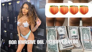 DAY IN MY STRIPPER LIFE #4 + vacuum therapy (non invasive bbl ) 🍑🤑