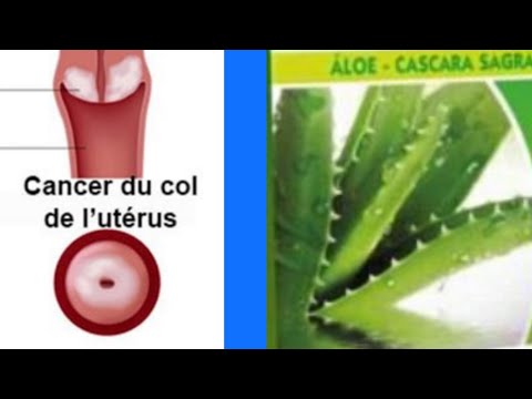 Men ki jan'w k fè prevansyon kont kansè kòl matris