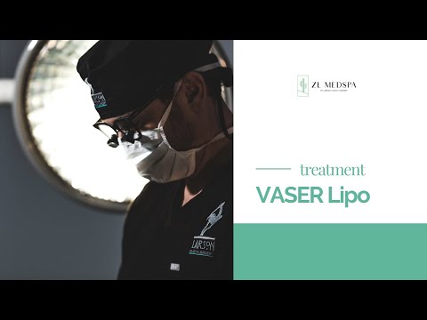 VASER Liposuction