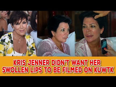 Kris Jenner wanted to stop filming of the hit show after suffering an alarming allergic reaction.