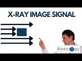 X Ray Image Signal What Impacts X Ray Image
