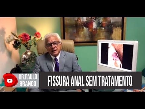 Dermatite di atopic di uno stadio su età Se la cura di psoriasi aiuta con un ospedale