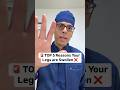 Top 5 Reasons Your Legs are Swollen ❌ Doctor Sethi