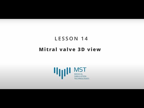 MST Masterclass - Lesson 14 - Mitral valve 3D view