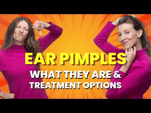 Pimples In Ear