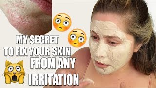 GET RID OF SKIN RASHES ON FACE | Allergic reaction