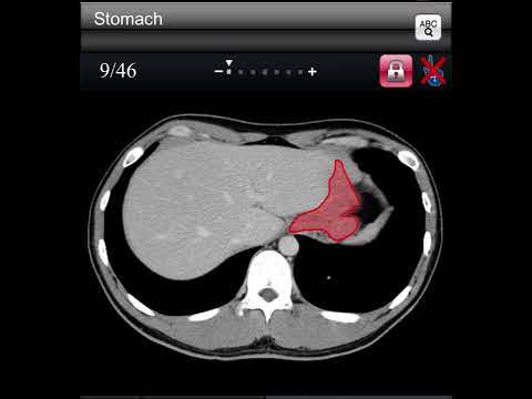 Anatomia por TC básica de órganos abdominales