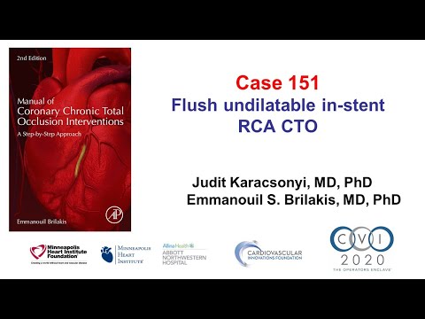 Case 151: Manual of CTO PCI - Flush, in-stent, undilatable aorto-ostial RCA CTO