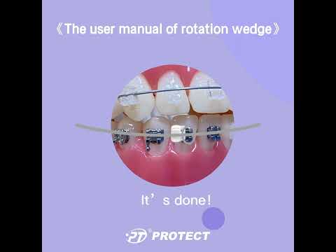 The user manual for rotation wedge. Unlock the potential of your orthodontic journey with PROTECT!