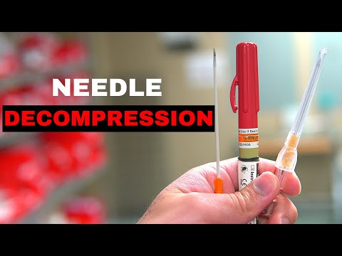 How To: Chest Needle Decompression