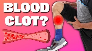 Is Your Calf Pain a Blood Clot!? Do Homan&#39;s Test and Find Out.