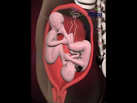 AMAZING TWINS FIGHTING INSIDE THE WOMB FOR SUPREMACY (3D ANIMATION)